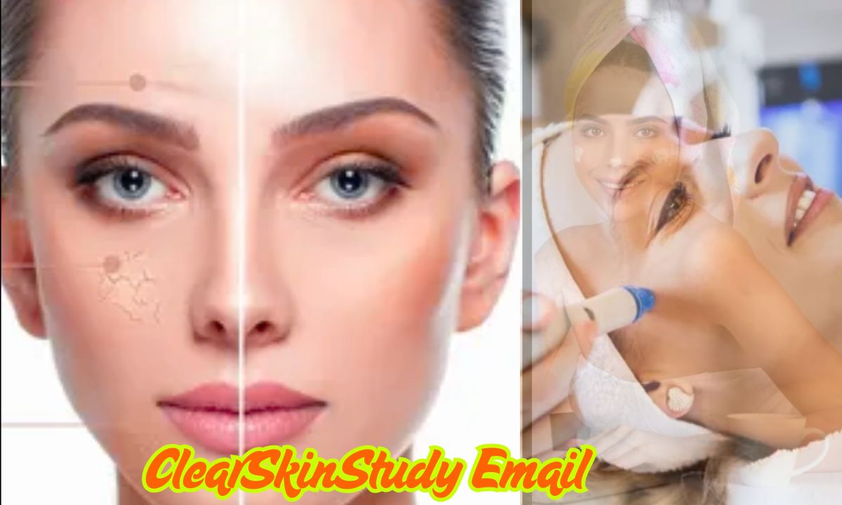 ClearSkinStudy Email