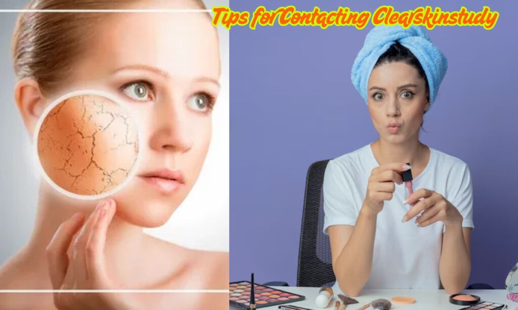 Tips for Contacting Clearskinstudy